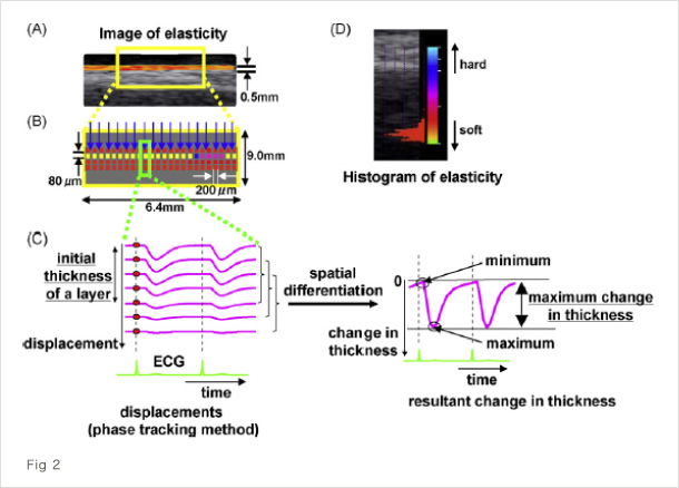 Fig 2